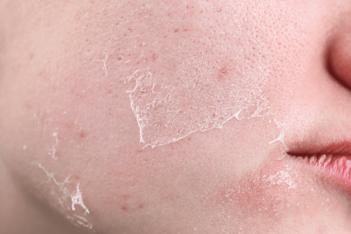 Skincare Routine for Dry Skin: A Complete Beginner's Guide